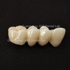 High Quality Perfect Perfect Aesthetic Zirconia Dentures Crown and Bridges with Cheap Price