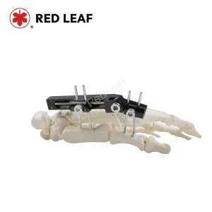 Professional Fracture Finger Track Vertical Axis External Fixator Palm Orthopedic Fixation