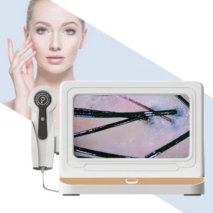 Hair &amp; Scalp Analyzer Scalp Microscope Camera Hair Follicle Detector Skin &amp; Hair Analyzer Hair Loss Analysis