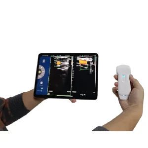Viatom Scanner