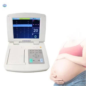 Monitor CTG