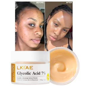 Hot Sell 7 Days Instant Whitening Cream Niacinamide Glycolic Acid Dark Spot Remover Moisturizing Brightening Face Cream