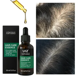 Private Label Hair Growth Oil Organic Baldness Hair Growth Regrowth Serum