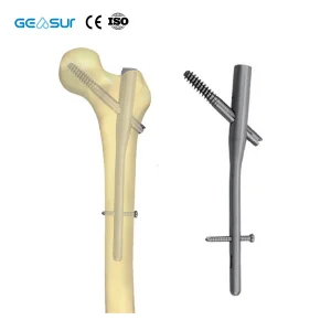 Geasure PFNA Femoral Intramedullary Nail Class III Implant Materials Instrument Set-Hospital Use Orthopedic Surgical Kit-Factory