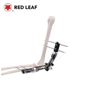 Elbow Joint Fixator