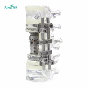 Manufacturer Direct Custom Titanium Alloy Implantable Interbody Fusion Cage Hospital Application Artificial Vertebral Body Class
