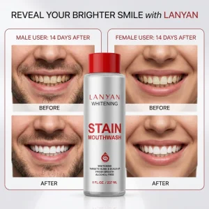 Alcohol Free Whitening Mouthwash