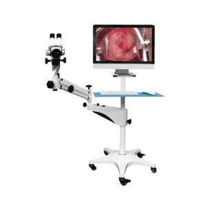 New Digital Colposcope Digital Electronic Video Colposcop Sony Camera Gynecological Colposcope with Stand Colposcopy