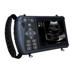 Portable Veterinary Full Digital Ultrasound Scanner MTR Model MTR-MUB-W1 CE Certified Built-in Battery for Animal Cattle Cow