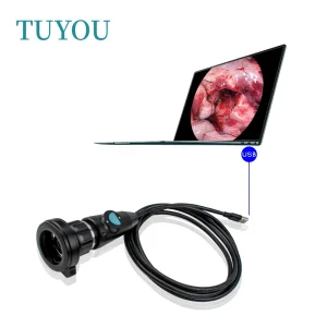 Portable Endoscopy