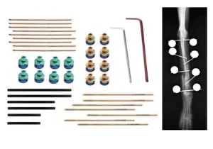 Hot Selling Vet Orthopedic Surgery Universal Mini External Fixation Instruments Tool System