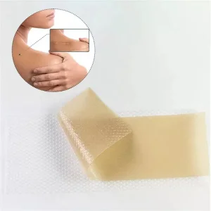 OEM Silicone Scar Sheet