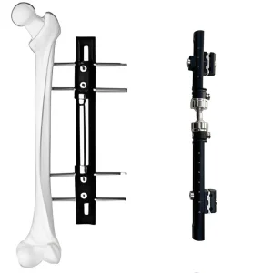 Surgical Implant Fixation