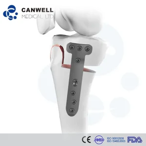 Canwell Hto High Tibia Osteotomy Titanium Implant Orthopedic Locking Plate