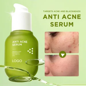 Facial Serum Manufacturer Tea Tree Oil Cleanses Pores Smooth Wrinkles Blemish-Prone Skin Private Label Acne Scars Serum for Face