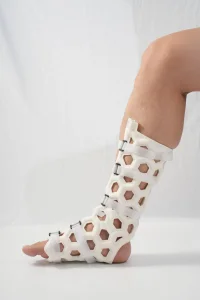 Waterproof and Breathable Orthopedic Products External Fixation Braces for Foot