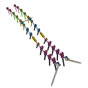 Titanium Alloy Spinal System