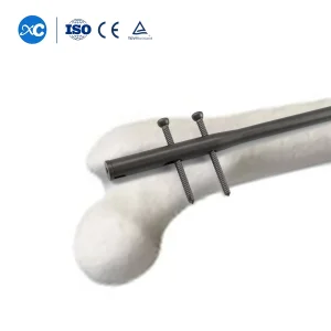 Lockable Intramedullary Nail Titanium Alloy