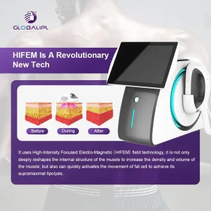 New Technology Body Sculpting Muscle EMS Abdominal Muscle Stimulator EMS Muscle Building