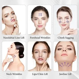 Wholesale Skin Tightening PDO Threads