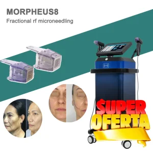 RF Skin Remodeling Technology
