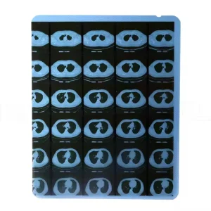 X-ray Film Solutions