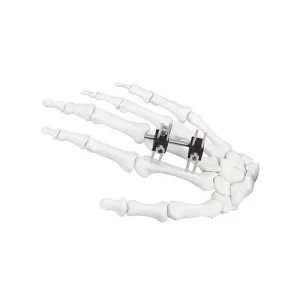 Surgical Instruments Mini Fixator Universal Type for Orthopedic Fixation