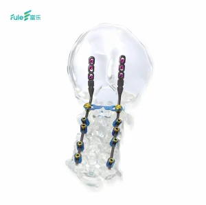 Anterior Cervical Spine Plate