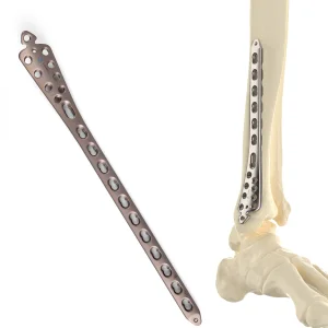 CANWELL Distal Medial Tibial Locking Plate 3.5mm Compression Bone Orthopedic Implants Trauma Fracture Surgery CE OEM Titanium