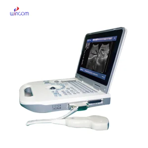 Portable Full Digital Laptop Ultrasonic Diagnostic System Ultrasound Scanner Machine with Probes for Clinic Hospital