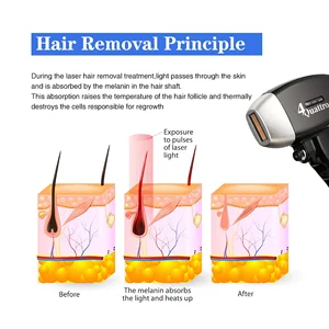 Portable Skin Rejuvenation Hair Removal Machine
