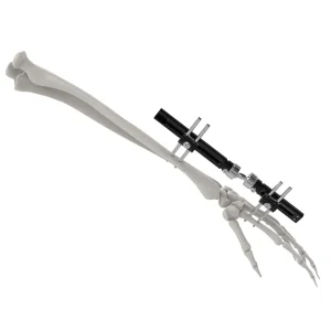 Canwell Mini External Fixator