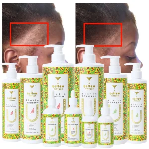 Your Own Brand Organic Shampoo