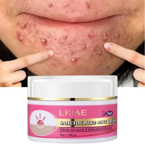 Salicylic Acid Whitening Cream
