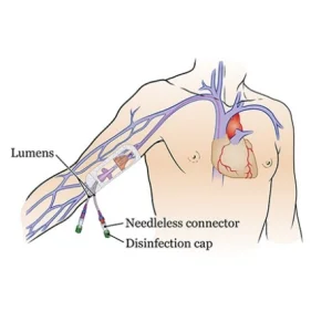 PICC Catheter