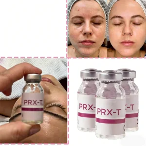 TCA Kojic Acid Chemical Peeling Ampoule Serum
