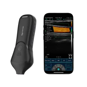 Handheld Innovative High-Definition Ultrasound Scanner Probe for Point-of-Care Emergency Exams