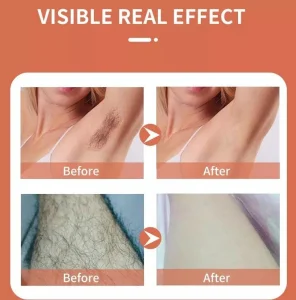Removedor de pelos a gelo compacto para rejuvenescimento, epilador para o corpo inteiro, doméstico, OEM, certificado CE