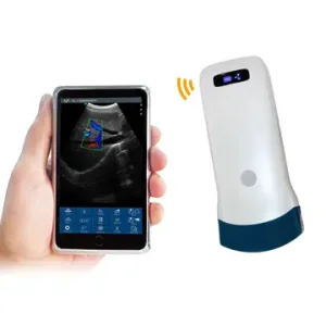 WiFi Ultrasound Probe