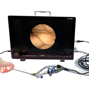 Sy-PS050 Hot Sale Full HD Video Endoscope System for Ent Urology Laparoscopy Endoscopy