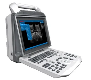 PT6150 Sistema de ultrasonido portátil médico móvil con LCD, Doppler color