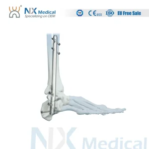 Nx Medical Titanium Orthopedic Orthopaedic Foot Ankle Fusion Intramedullary Nail