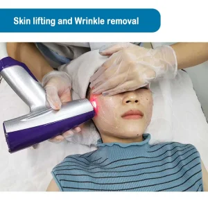 Fractional Microneedling RF Fractional Radio Frequency Beauty Equipment Matrix for Salon Facelift Skin Tightening