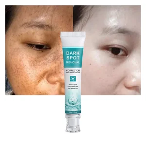 Wholesale Dark Spot Removal Cream