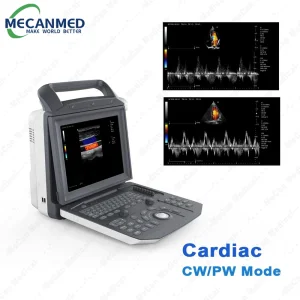 Escáner de ecocardiografía digital portátil completo, máquina de ultrasonido Doppler color portátil para embarazo