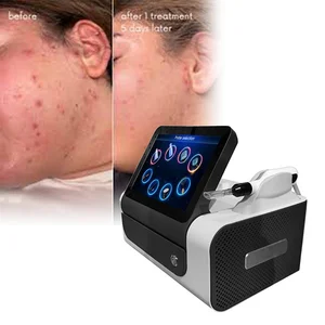 Beauty Device Oem Odm Face Air Cleaning Derma Roller Warm Jet Fibro Fibroblast Korean Cool Portable Cold Plasma Machine