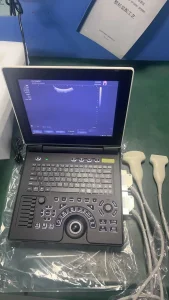 Máquina de ultrasonido LCD