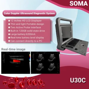U30c Portable 12.1-Inch High Resolution Display Screen Color Doppler Ultrasonic Diagnostic System