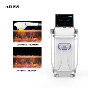ADSS Laser Hair Removal Face IPL 1200 with Cooling System OPT Laser Hair Removal for Dark Skin