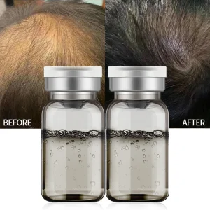Anti Hair Loss Treatment Stem Cell Essence
